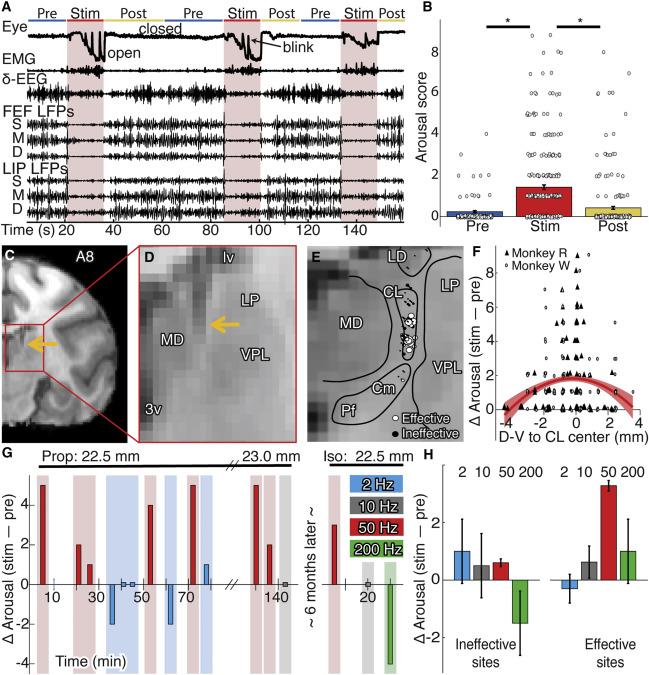 大脑深处丘脑的“意识开关”？